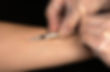 biopuncture treatment