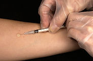 biopuncture treatment