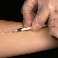 Injection