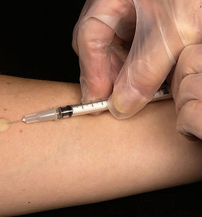 Injection