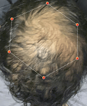 revian_1_male_1before.png