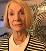 Jean Labban 16 days post op.JPG
