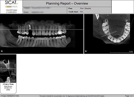 CBCT planning images (2)