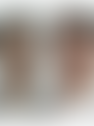 Kedutan Nasolabial dan kekenduran muka