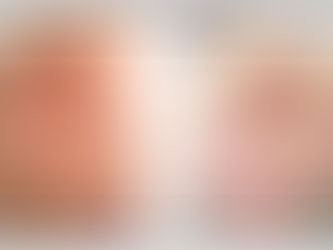 My abdominal skin doesn’t sag anymore