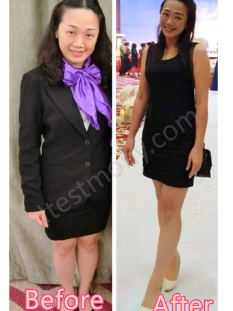 Menikmati Kurus Dengan Sihat, Kulit Tidak Longgar Selepas Menjadi Kurus