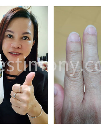 Saya Juga Berpeluang Untuk Menumbuhkan Kuku Panjang!