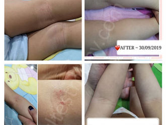 REOXlife Junior Mediterranean Kids for excessive skin sensitivity