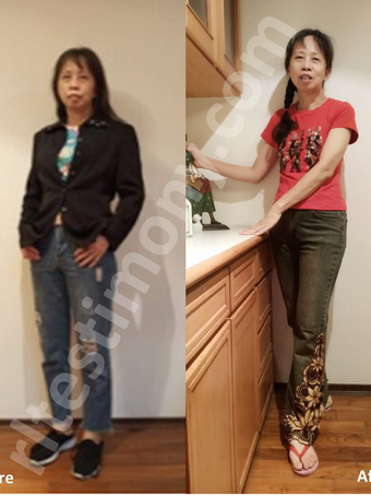 Mengurangkan Sakit Leher