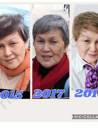 Kedutan, jeragat, kulit kusam