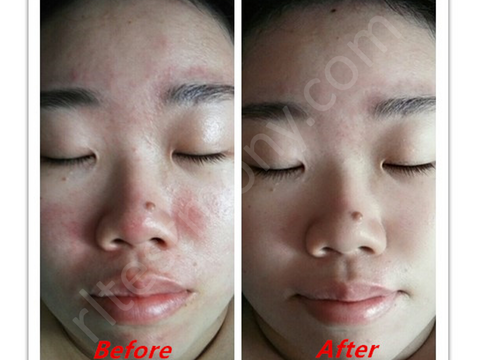 对猫毛和灰尘过敏