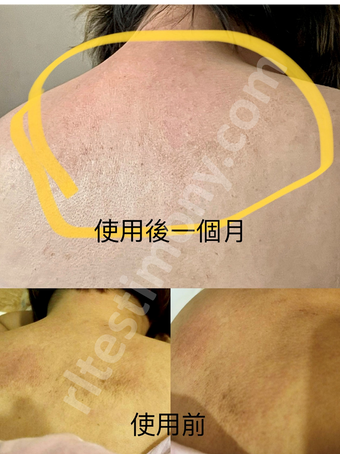 Memperbaiki Keradangan Kulit, Menemui Kembali Keceriaan Kulit