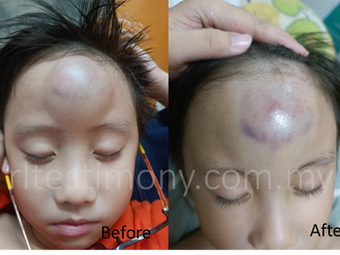 Tanpa Kebimbangan Dengan H+