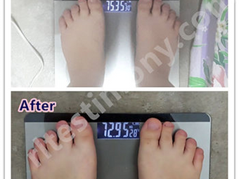 Berat badan saya bertambah dan saya dipanggil auntie pada usia 18 tahun