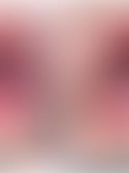 Dengan H+, Tiada Rasa Takut Walaupun Terkena Penyakit Tangan, Kaki, dan Mulut!