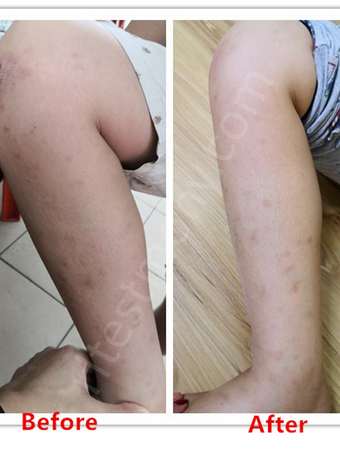 Meningkatkan imuniti anak, menambahbaikkan masalah kulit sensitif