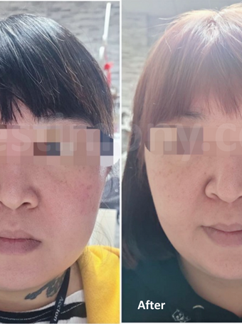 Sepuluh Hari untuk Wajah dan Badan yang Lebih Sihat, Tidak Lagi Susah