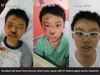 Jatuh Dari Basikal Secara Tidak Sengaja