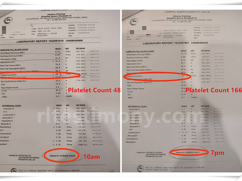 孩子患上骨痛热症险需入院