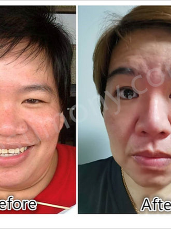 Lutut saya tidak Sakit lagi!