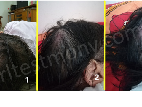 宝贝滑倒重摔头部