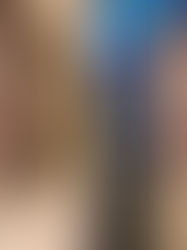 Selepas Menggunakan Redoxy selama 3 Bulan, Warna Kulit Saya dan Bintik-Bintik Gelap Saya Membaik Sec