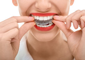 Dentista Urgencia, Dental Providencia, dentistas en providencia, urgencia dental, ortodoncia, implantes , dentales implantes dentales, urgencia dental