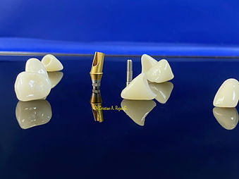 Clinica dental en providencia, implantes en Santiago, mejores clinicas dentales de Santiago, Dentistas