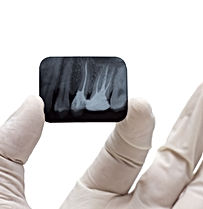 Urgencia Dental, Dentistas Urgencia, implantes dentales, dentistas en providencia