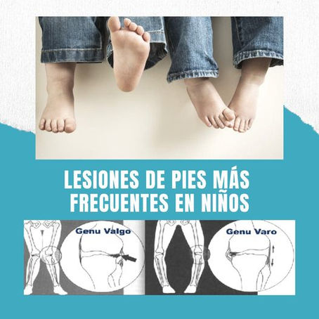 Lesiones más frecuentes en niños.