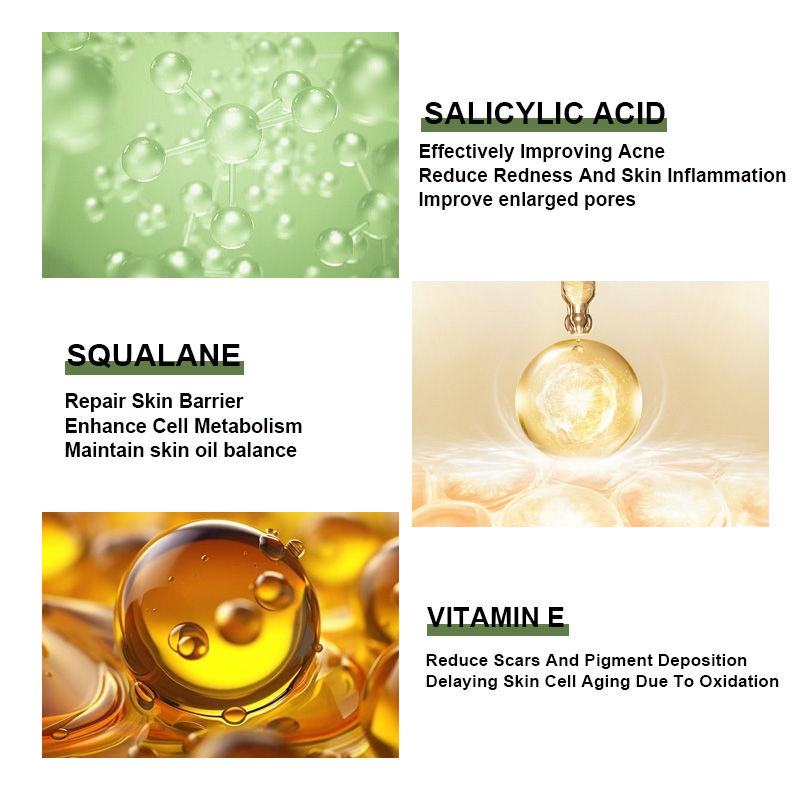 Thumbnail: Anti-Acne Face Serum Salicylic Acid Acne Removing Essence Squalane Vitamin E Moi