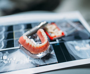 dental-prosthetics-and-x-rays-on-a-table-2026-01-06-09-24-41-utc.jpg