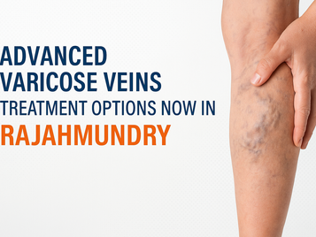 Varicose Veins Treatment in Rajahmundry