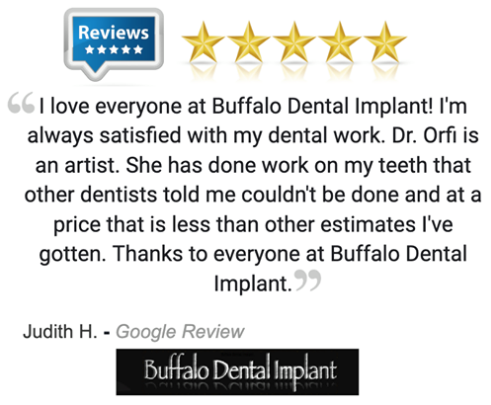 Buffalo Dental Implant patient review