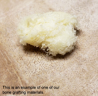 Dental Implant bone graft