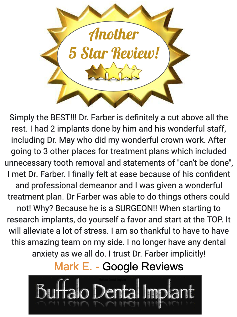 Buffalo Dental Implant patient review
