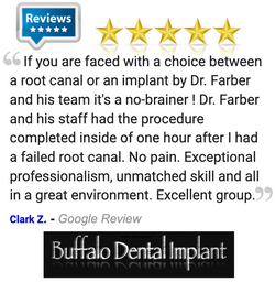 Buffalo Dental Implant Review