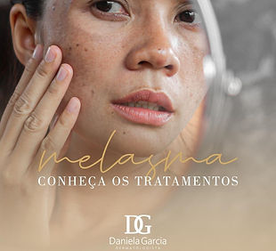 Tratamento de Melasmas