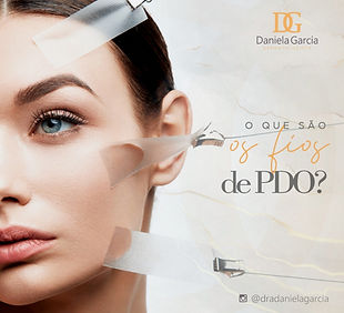 Fios de PDO