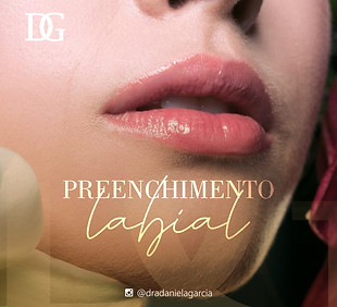 Preechimento Labial