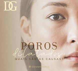 Poros Dilatados