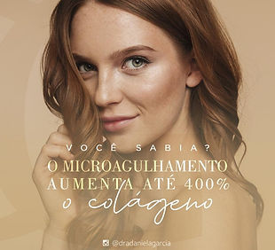 Microagulhamento