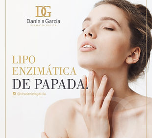 Lipo Enzimática de Papada