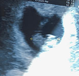 kleines Baby auf dem ersten Ultraschallbild