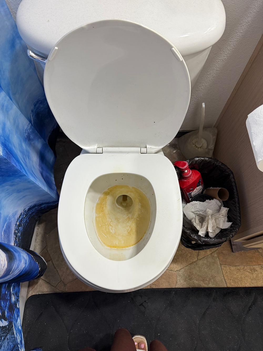 Toilet Before