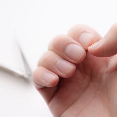 深爪・巻き爪・二枚爪などの悩み