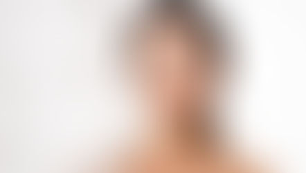 Yağlı Saçlara Çözüm Olabilecek Öneriler