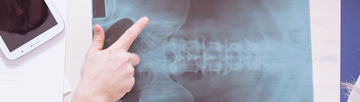 X-Ray Results