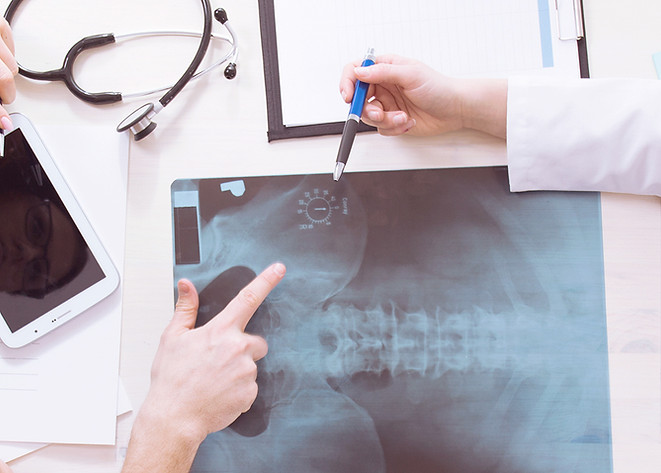 X-Ray Results