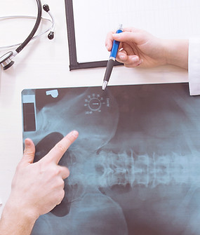 X-Ray Ergebnisse